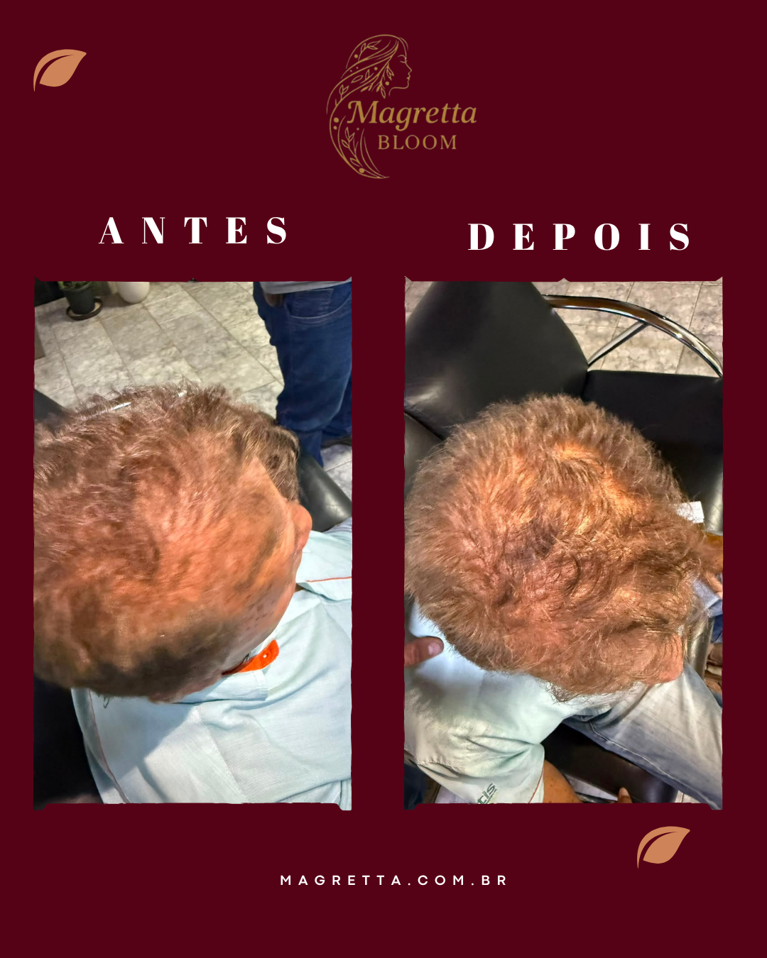 Registro de cliente Magretta Bloom: antes e depois