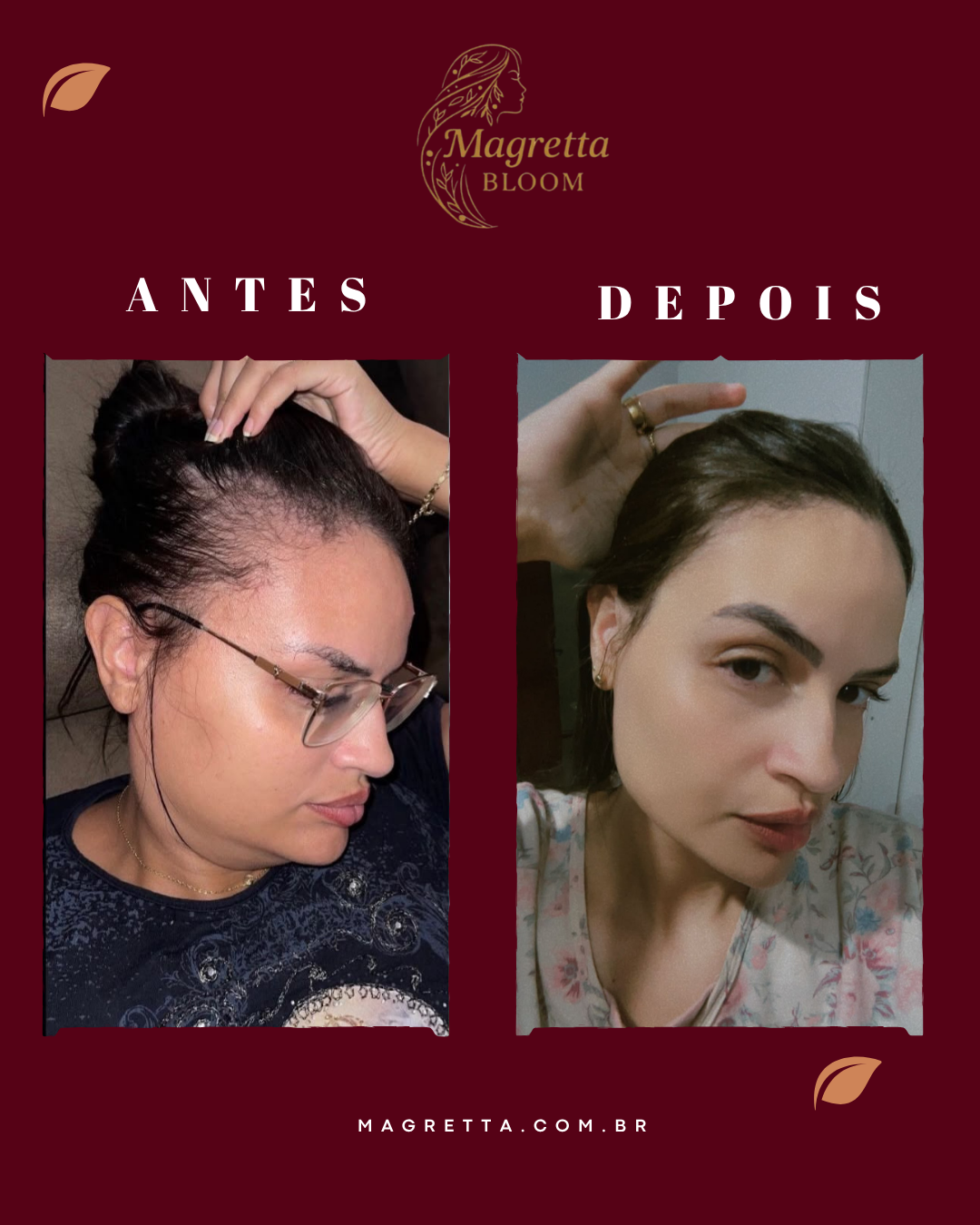 Registro de cliente Magretta Bloom: antes e depois